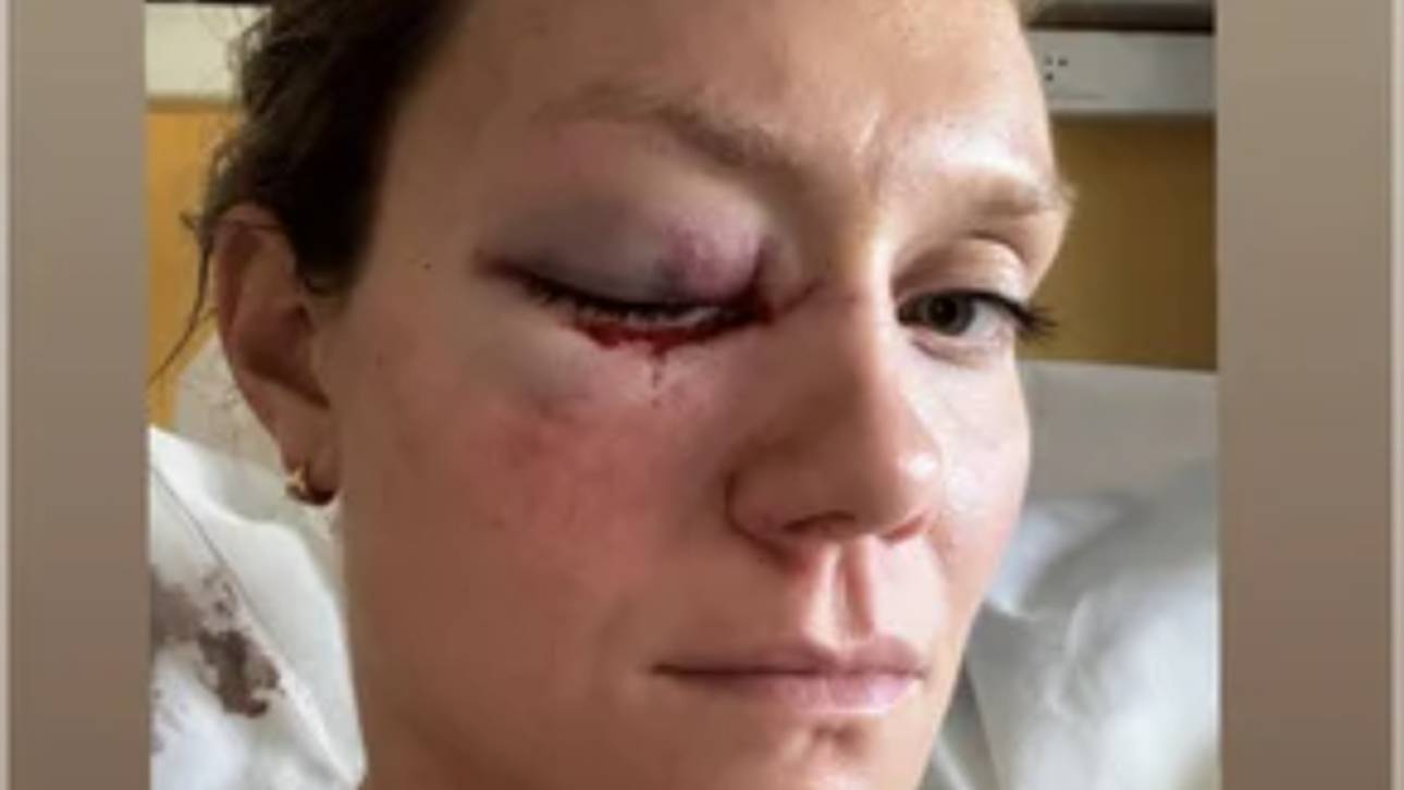 Micha Hancock war nach Olympia in einen Autounfall verwickelt