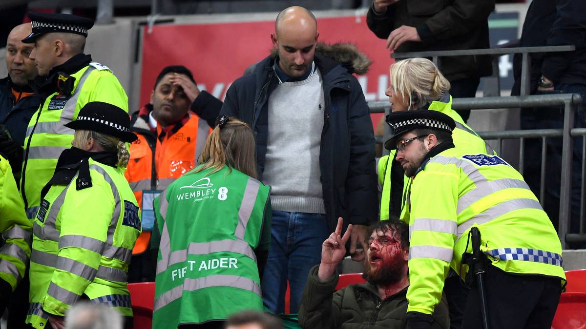 Die versuchen ihn zu überreden, seine Wunden ärztlich versorgen zu lassen