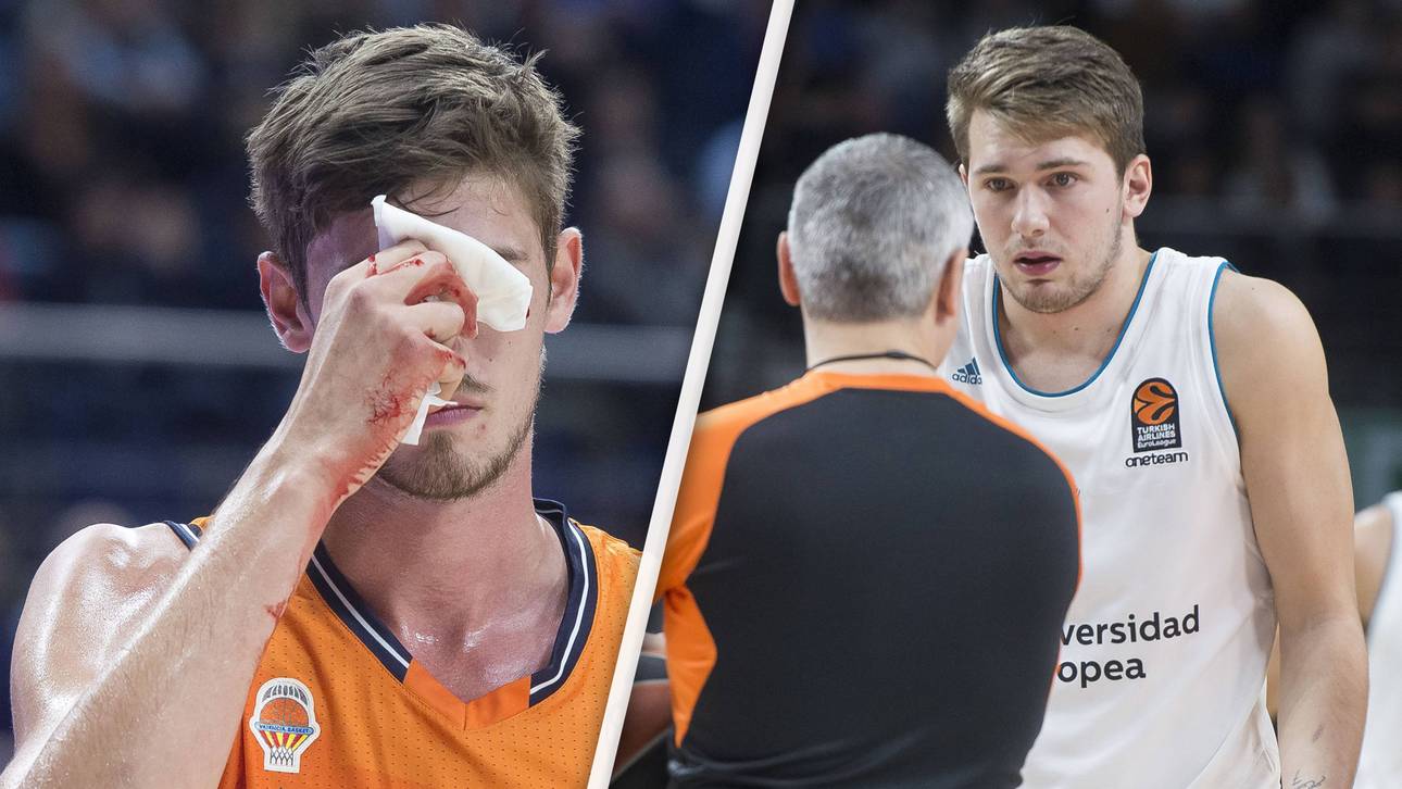 NBA-Hoffnung Doncic rastet aus