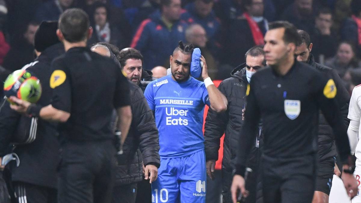Wurfgeschosse in Ligue 1: Regierung greift ein