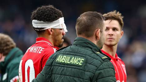 Beim 3:1-Erfolg von Nottingham Forest über den FC Chelsea rauschen Blues-Torwart Robert Sánchez und Forest-Profi Morgan Gibbs-White ineinander und erleiden jeweils eine Platzwunde. Über Instagram meldet sich Gibbs-White, den es etwas schlimmer erwischt hat.