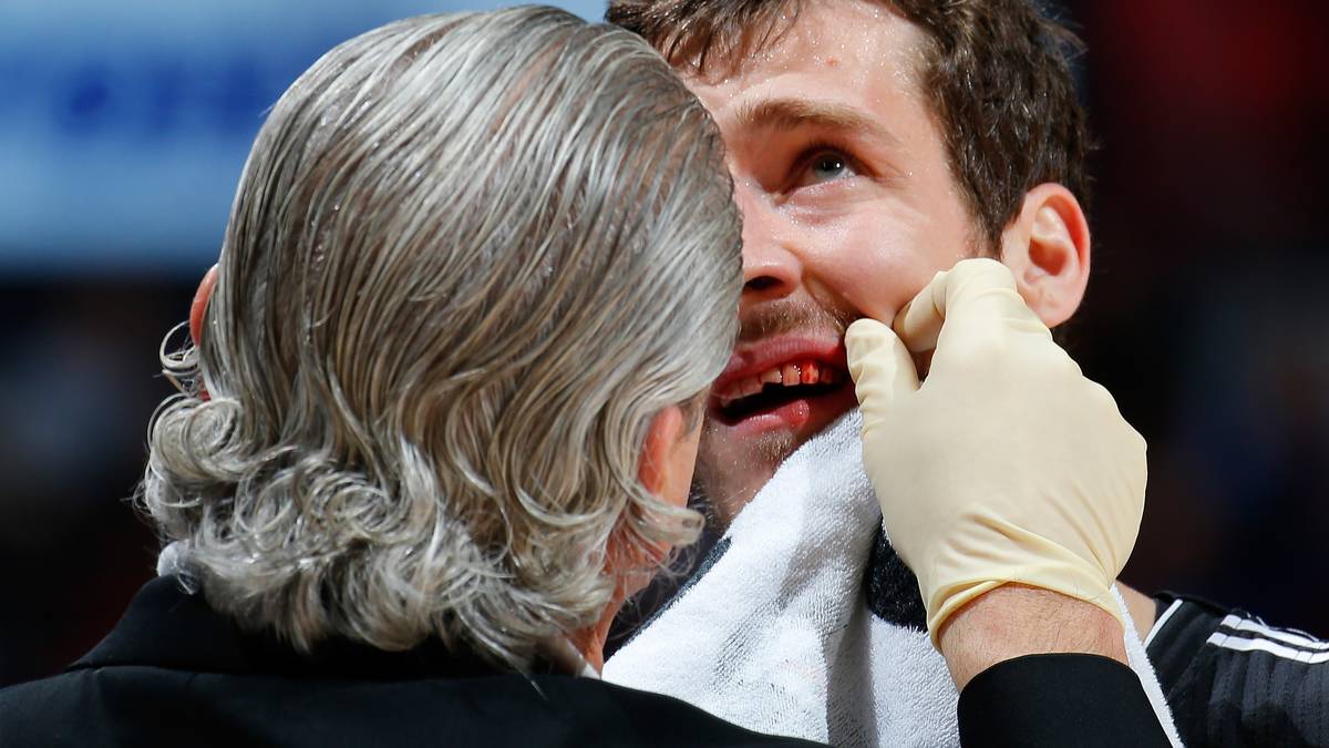 Schrecksekunde für Goran Dragic: Der Spielmacher der Miami Heat bekommt bei den Atlanta Hawks den Ellbogen von Gegenspieler Al Hoford ins Gesicht und verliert einen Zahn. Autsch!