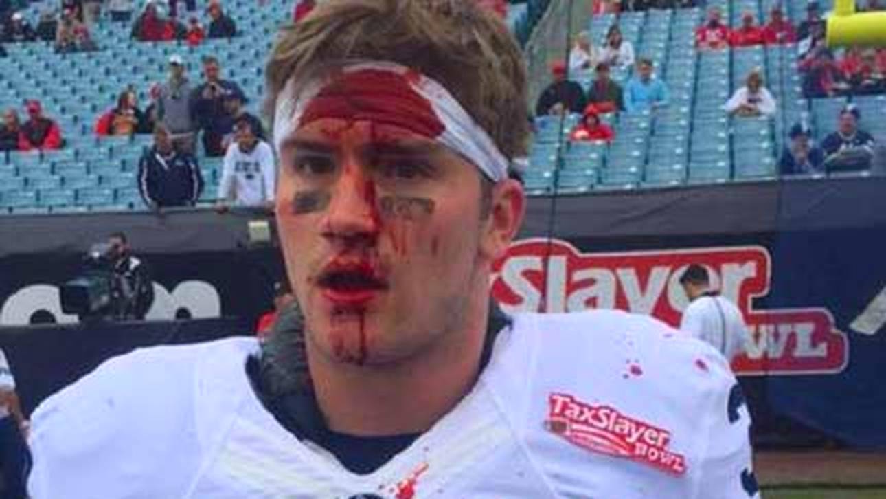 Kopfnüsse werden zu blutigem Desaster