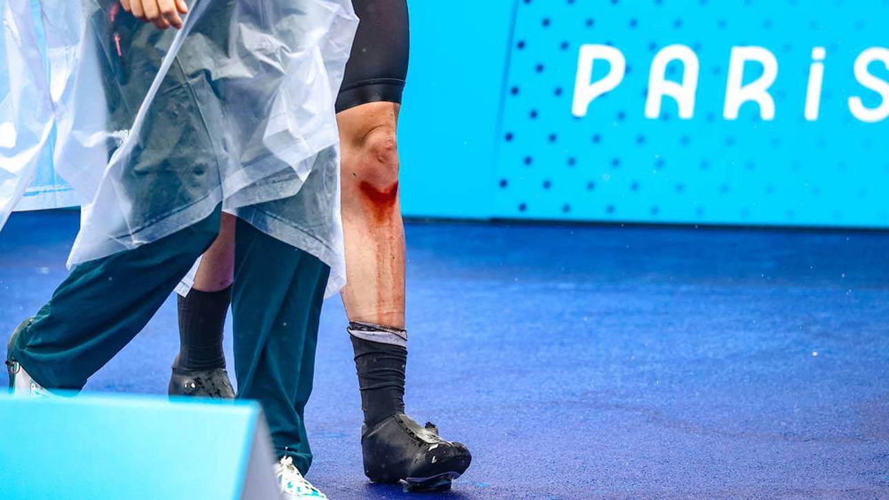 Unschöne Bilder bei Radrennen