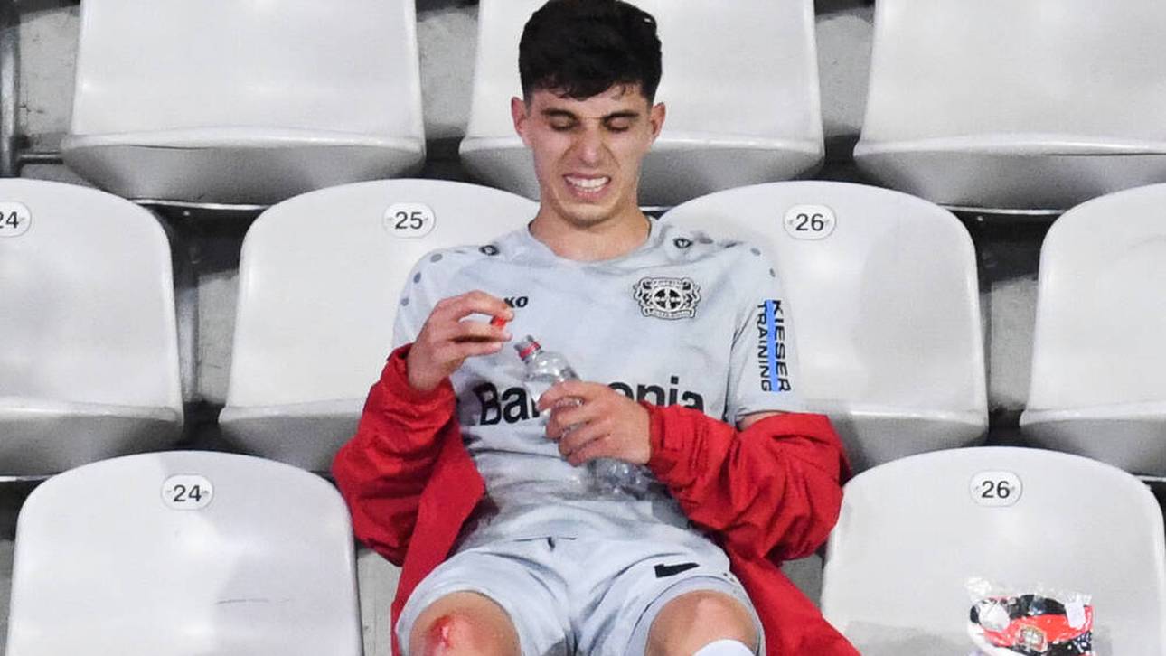 Nach seiner Auswechselung saß Havertz mit blutendem Knie auf der Tribüne