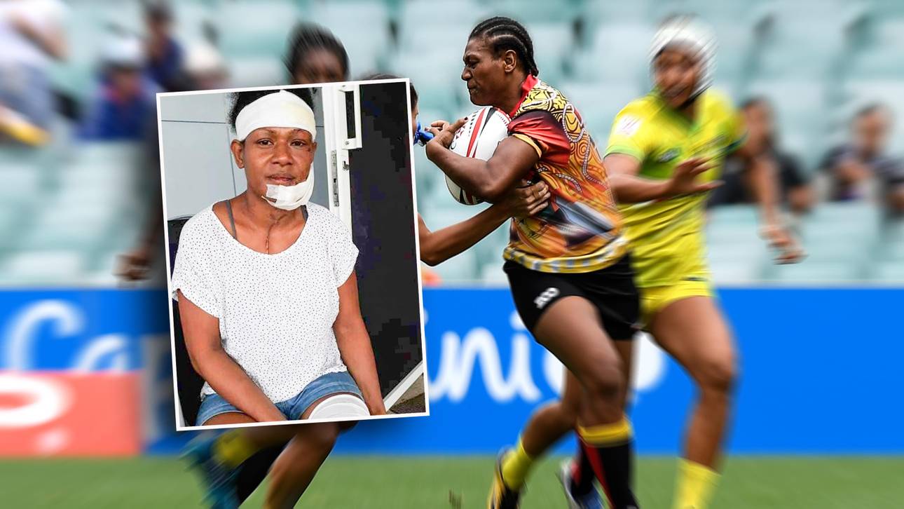 Boxerin mit Bügeleisen malträtiert