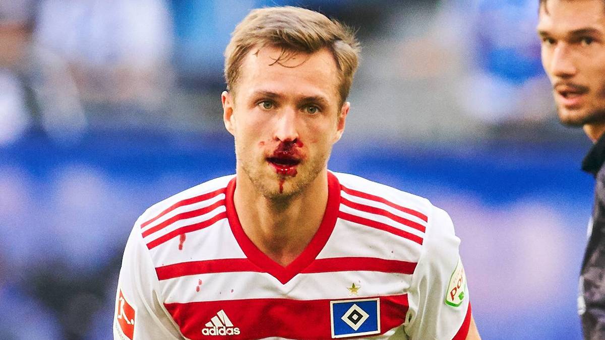 Kurios: Hamburgs Matti Steinmann muss wegen einer blutigen Nase drei Minuten zuschauen, weil erst ein Zeugwart in die Kabine sprinten musste, um ein frisches Trikot für ihn zu besorgen. Mit dem blutbefleckten Shirt ließ ihn Schiedsrichter Benjamin Cortus nicht  zurück auf den Platz