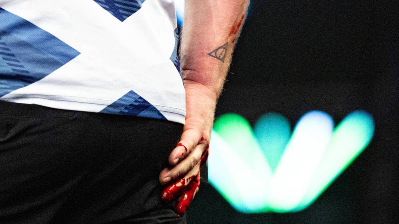 Cameron Menzies verlor bei der Darts-WM die Nerven und schlug sich die Hand blutig