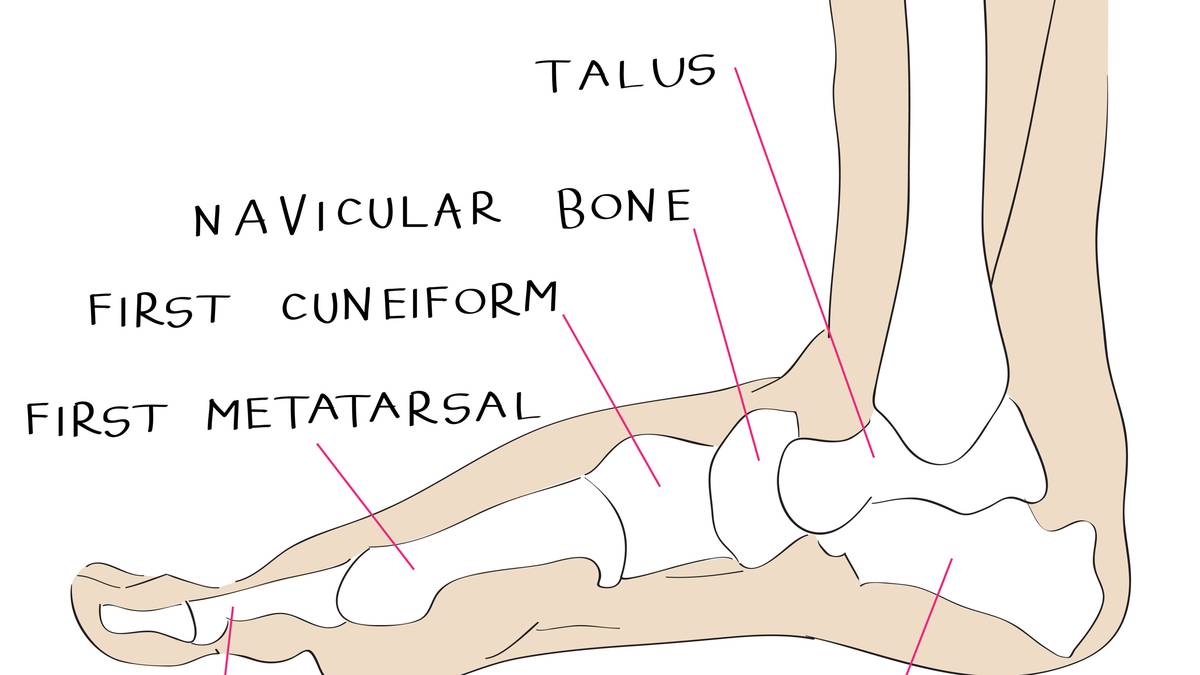 Bei Rafael Nadal ist das Kahnbein ("navicular bone") schwer beschädigt