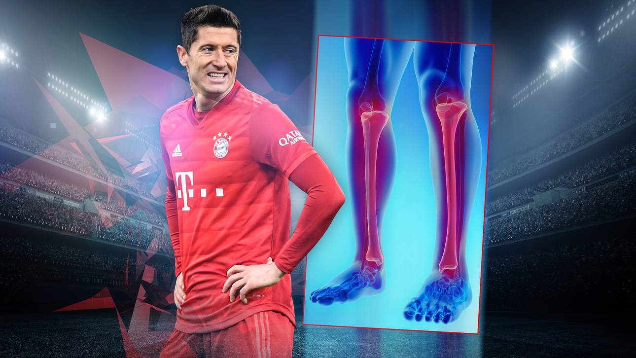 Sportarzt erklärt Lewandowski-Bruch