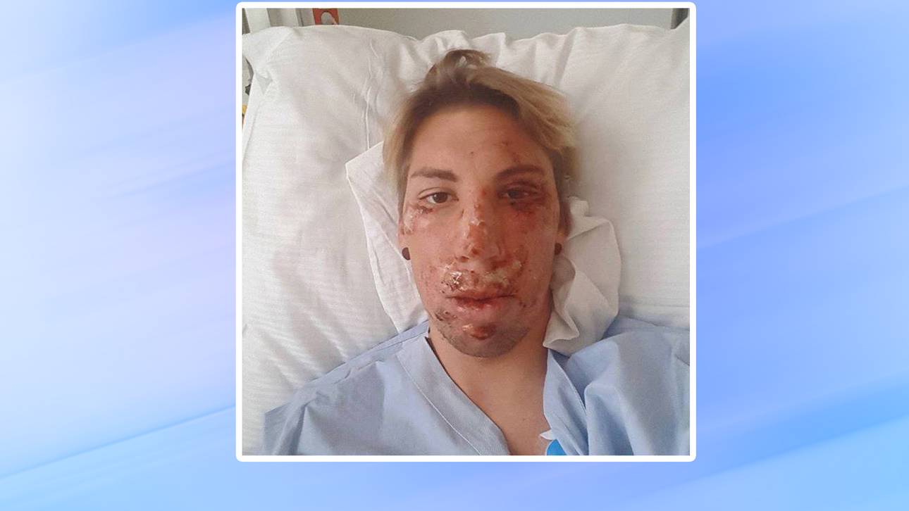 Diethart scherzt nach Horror-Sturz