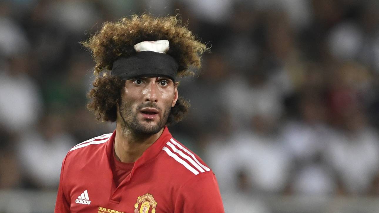 Marouane Fellaini von Manchester United zog sich gegen Real Madrid eine Kopfverletzung zu
