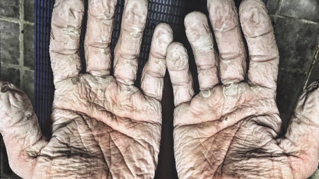 Olympiasieger zeigt Schock-Foto