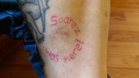 Das passende Tattoo um die Bisswunde: "Luis Suarez was here"