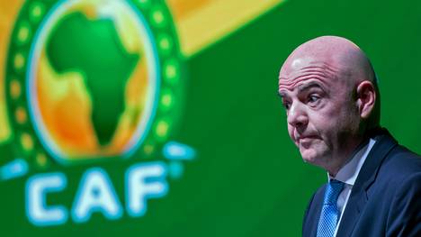 FIFA-Präsident Gianni Infantino sieht sich bei der WM-Vergabe 2026 mit schweren Vorwürfen konfrontiert