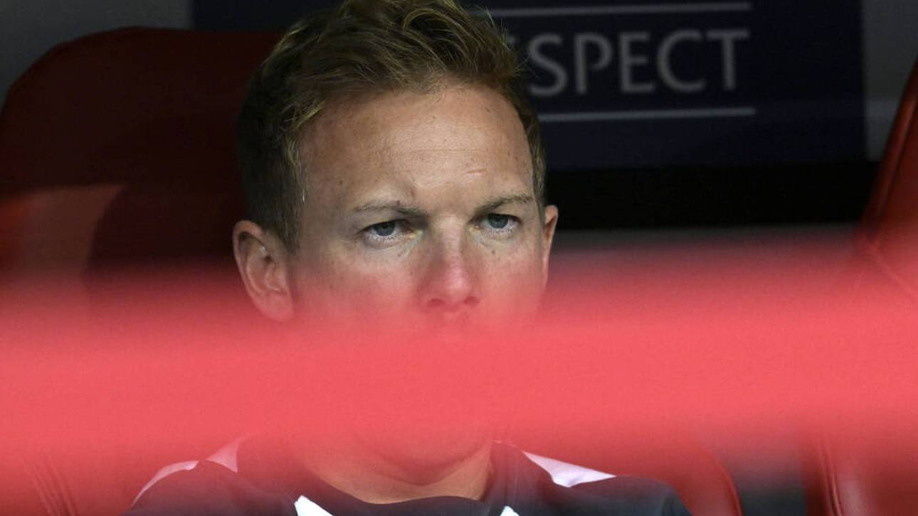 Das stößt Nagelsmann sauer auf