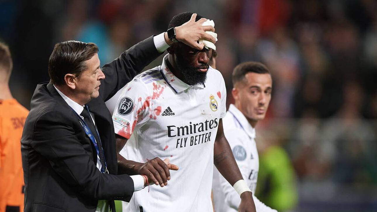 Real im Clásico ohne Rüdiger