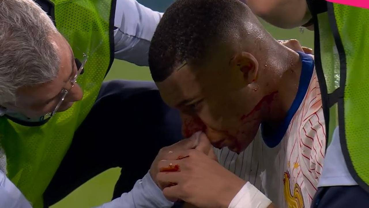 „Ein Unding“: Kritik an Mbappé