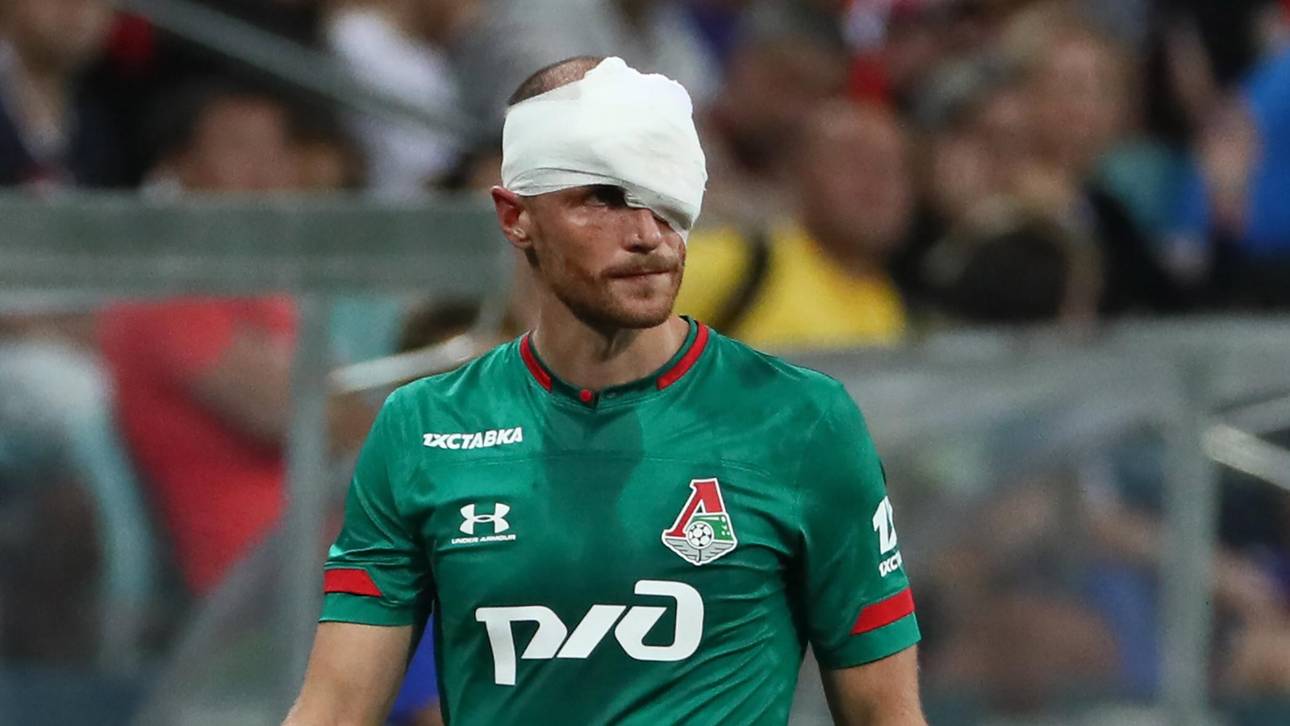 Höwedes mit Kopfverletzung