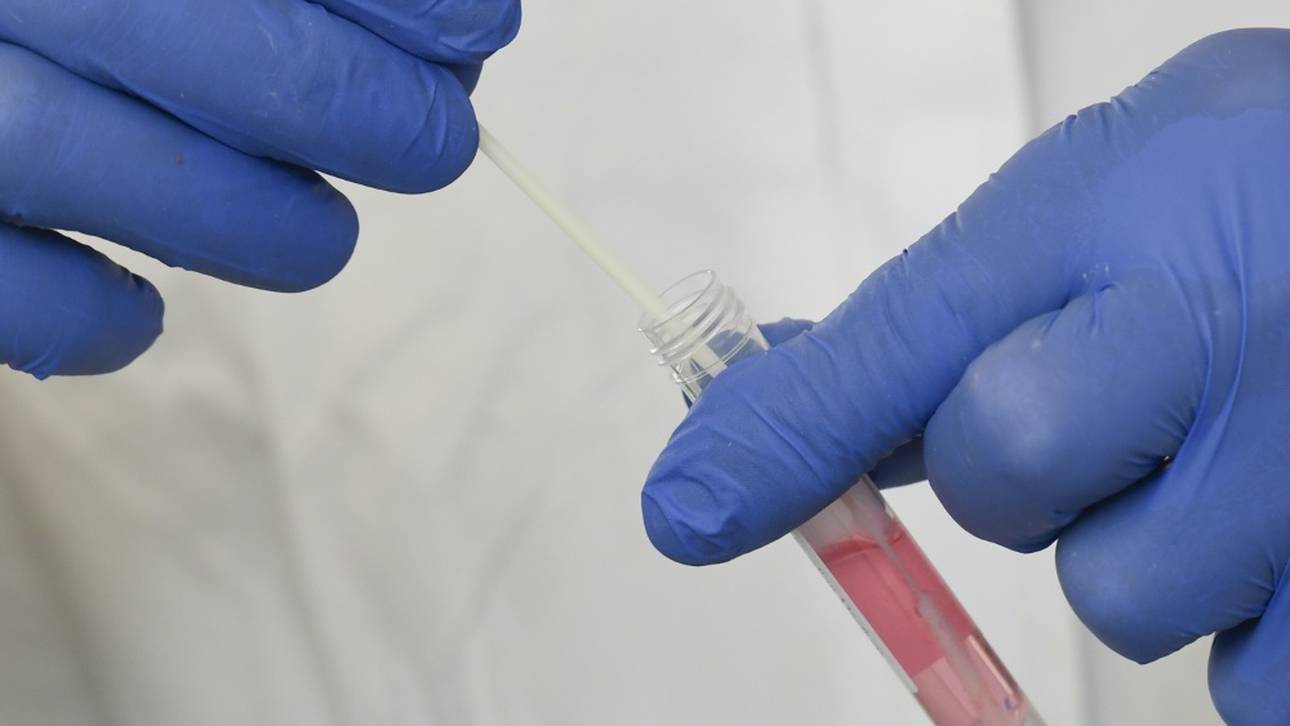 Vorerst keine weiteren Fälle bei TSG