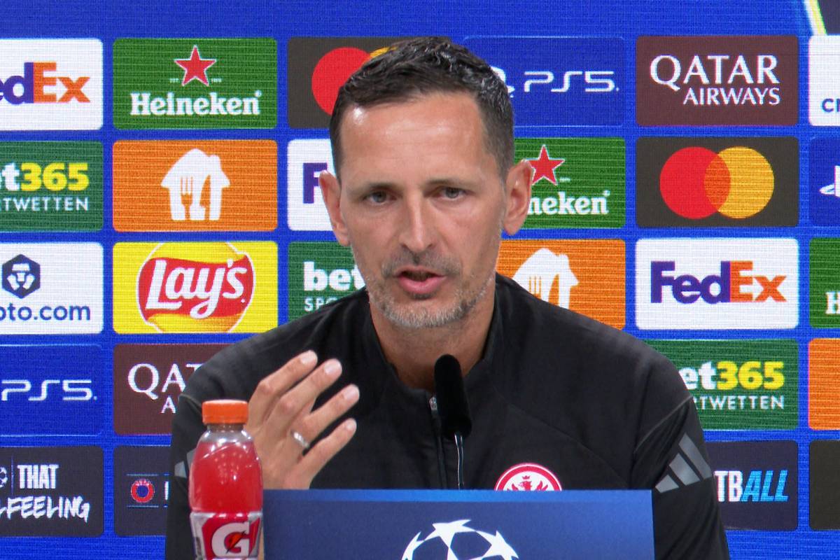 Mit Leroy Sané trifft Eintracht Frankfurt auf einen alten Bekannten aus der Bundesliga. Dino Toppmöller weiß um dessen Qualitäten und schwärmt vom Ex-Bayern-Star.