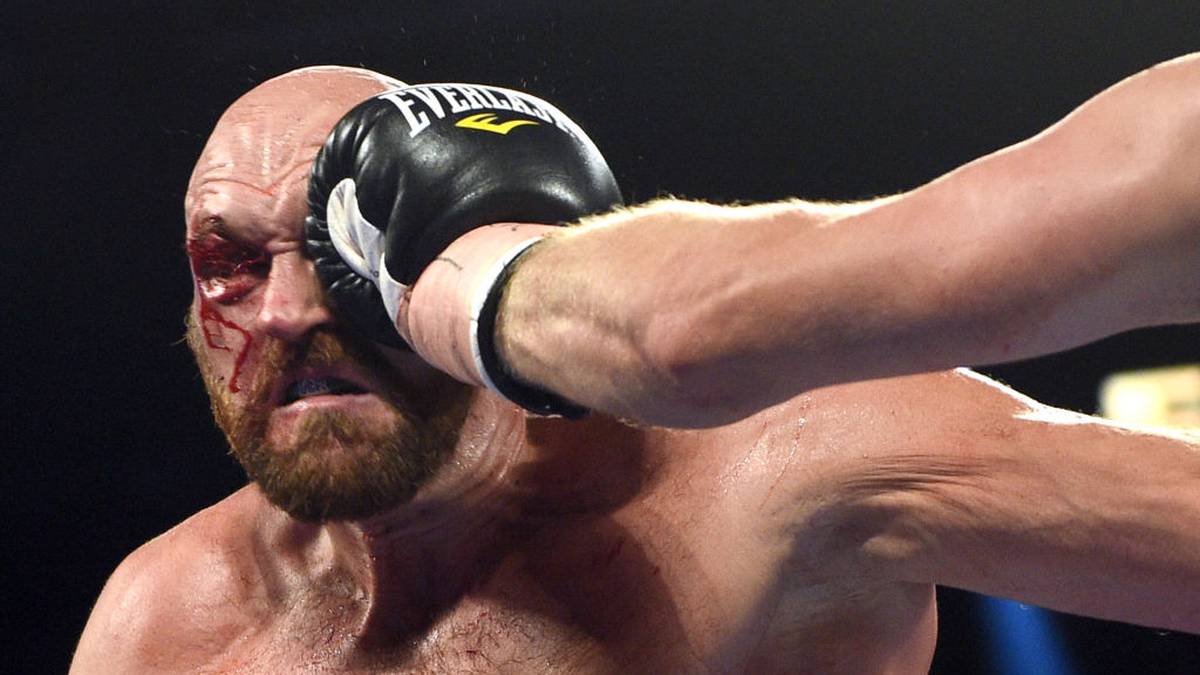 In der dritten Runde erleidet Fury einen heftigen Cut über dem rechten Auge - der ihn für den Rest des Kampfs beschäftigen wird