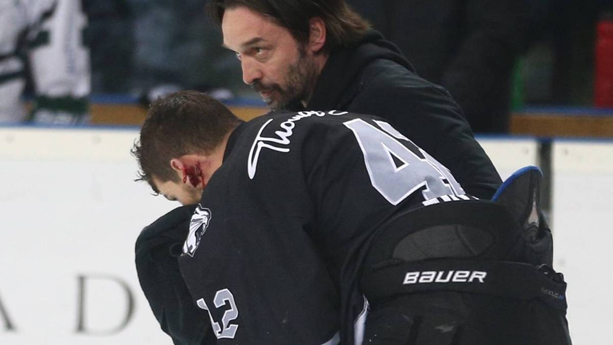 Auch in der DEL geht es mitunter brutal zu. Im entscheidenden Viertelfinal-Spiel der Saison 2016/17 gegen die Augsburger Panther (5:3) wird Nürnbergs Yasin Ehliz nach einem Schlagschuss seines Teamkollegen Patrick Reimer vom Puck direkt am Ohr getroffen