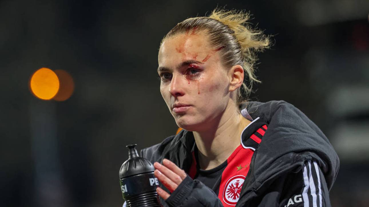 Schreckmoment um DFB-Stürmerinnen