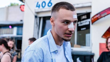 Tim Lemperle spielt mit der TSG Hoffenheim eine herausragende Bundesliga-Saison. Der Angreifer spricht im SPORT1-Interview auch über seinen aneckenden Charakter und die Party-Schlägerei im letzten Mai, die ihn einen Einsatz im Aufstiegsspiel mit dem 1. FC Köln kostete.