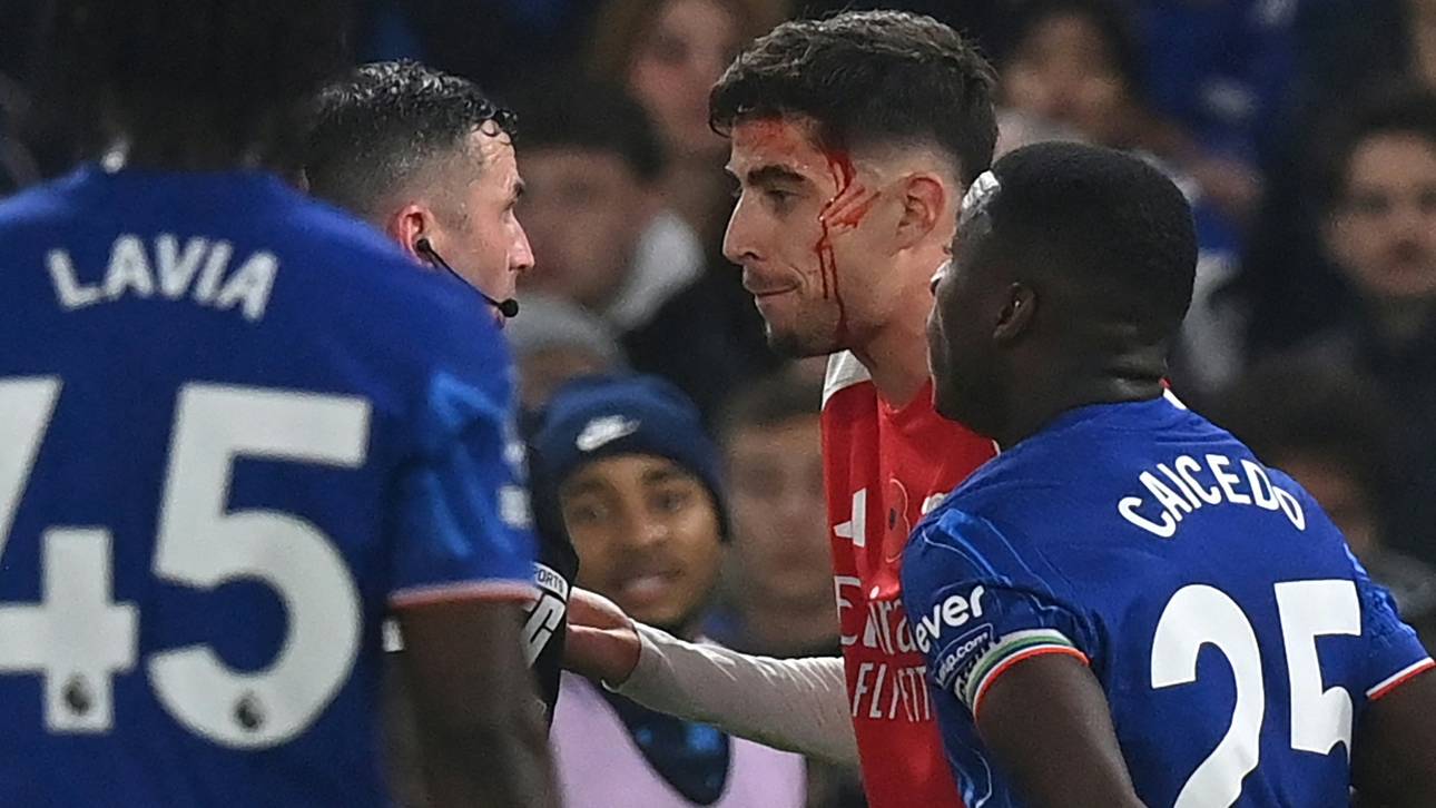 Blutiger Havertz! Arsenal verpasst Sieg