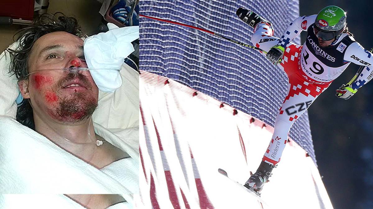 Bank hat aber Glück im Unglück: Aus dem Krankenhaus postet er ein Bild, gibt Entwarnung. Was er davonträgt, sind jedoch eine Gehirnerschütterung und Hautabschürfungen 