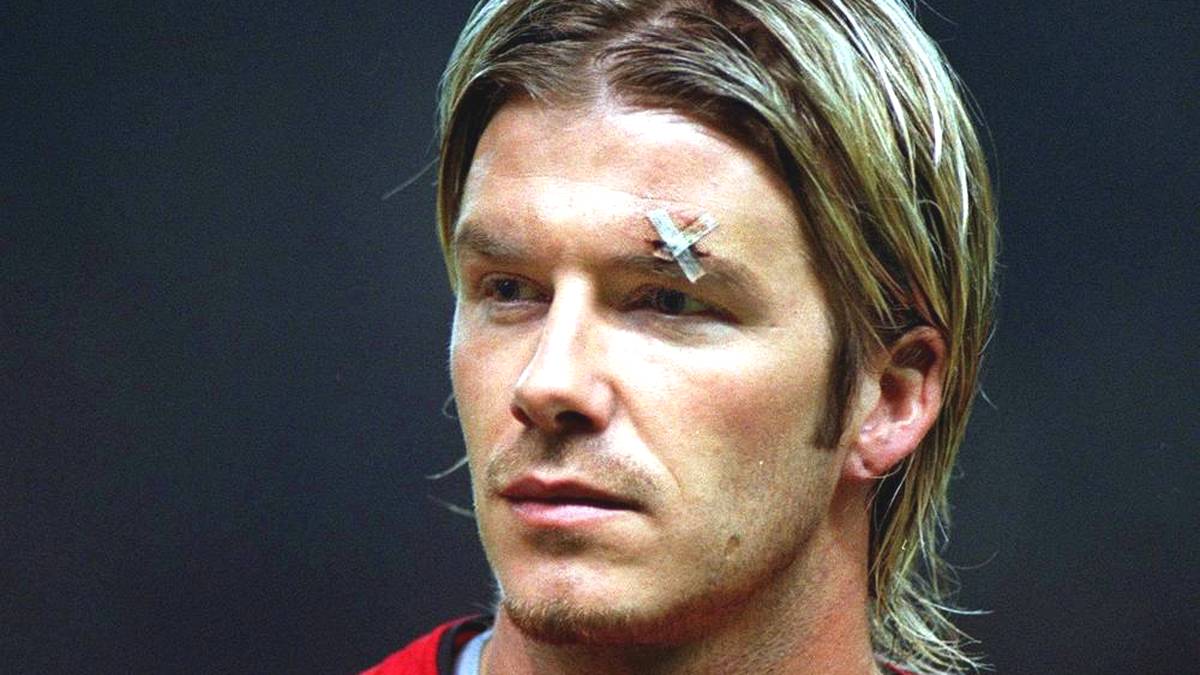 David Beckham mit Verletzung über dem Auge