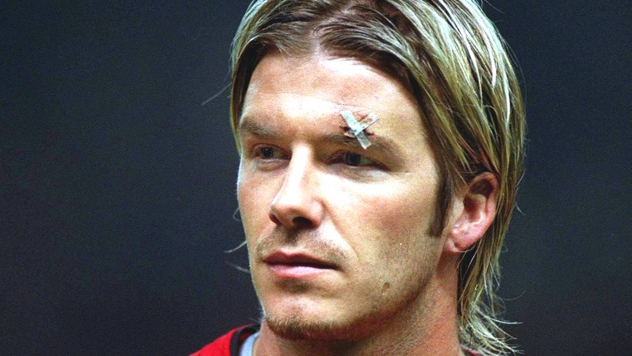 David Beckham mit Verletzung über dem Auge