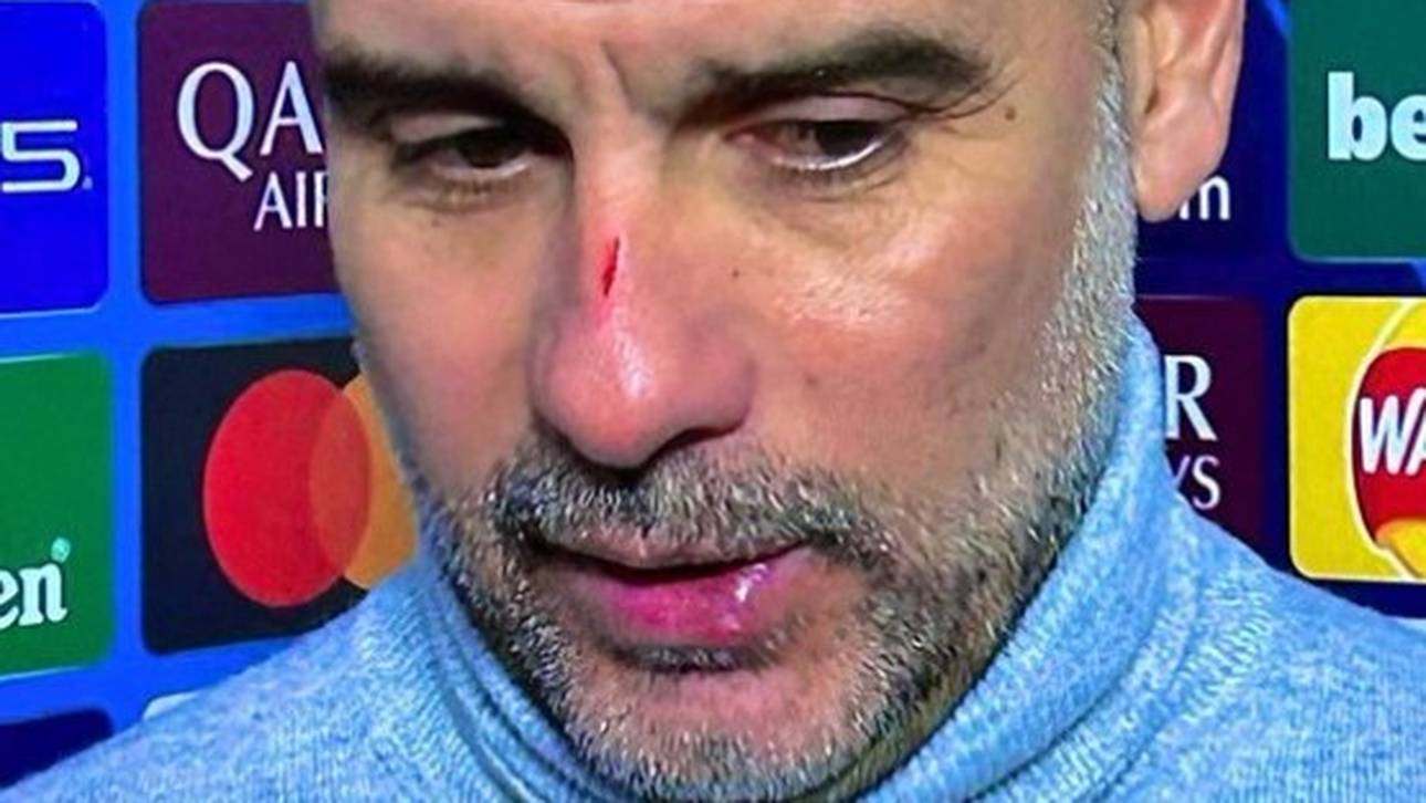 Guardiola entschuldigt sich