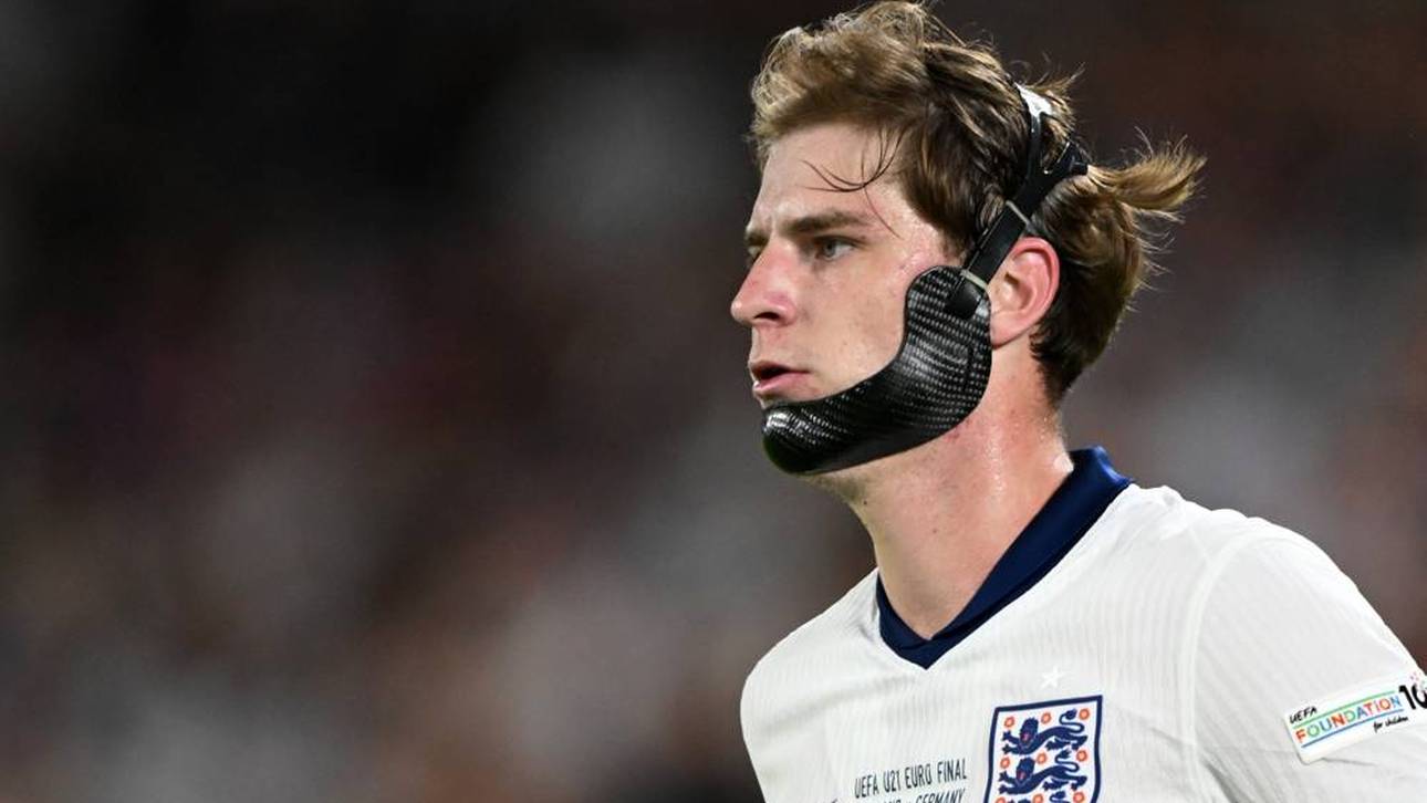 Alex Scott sielte bei der U21-EM mit einem kuriosen Kieferschutz für England