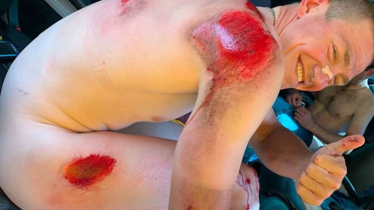 Radprofi schockiert mit Sturz-Foto