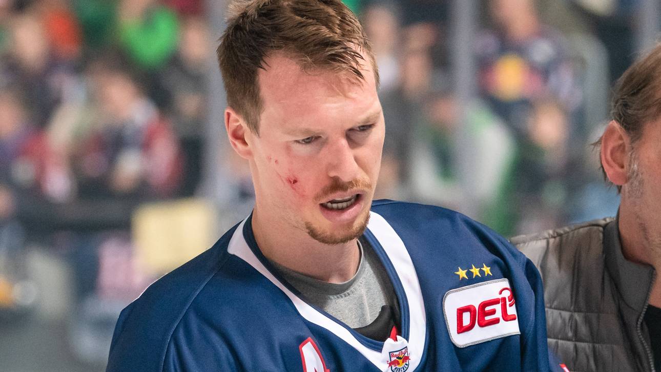 Nach Kopftreffer: Parlett fällt aus