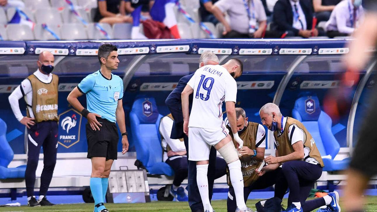 So ist der Stand bei Benzema