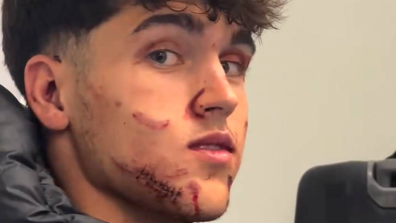 Barca-Juwel schwer gezeichnet