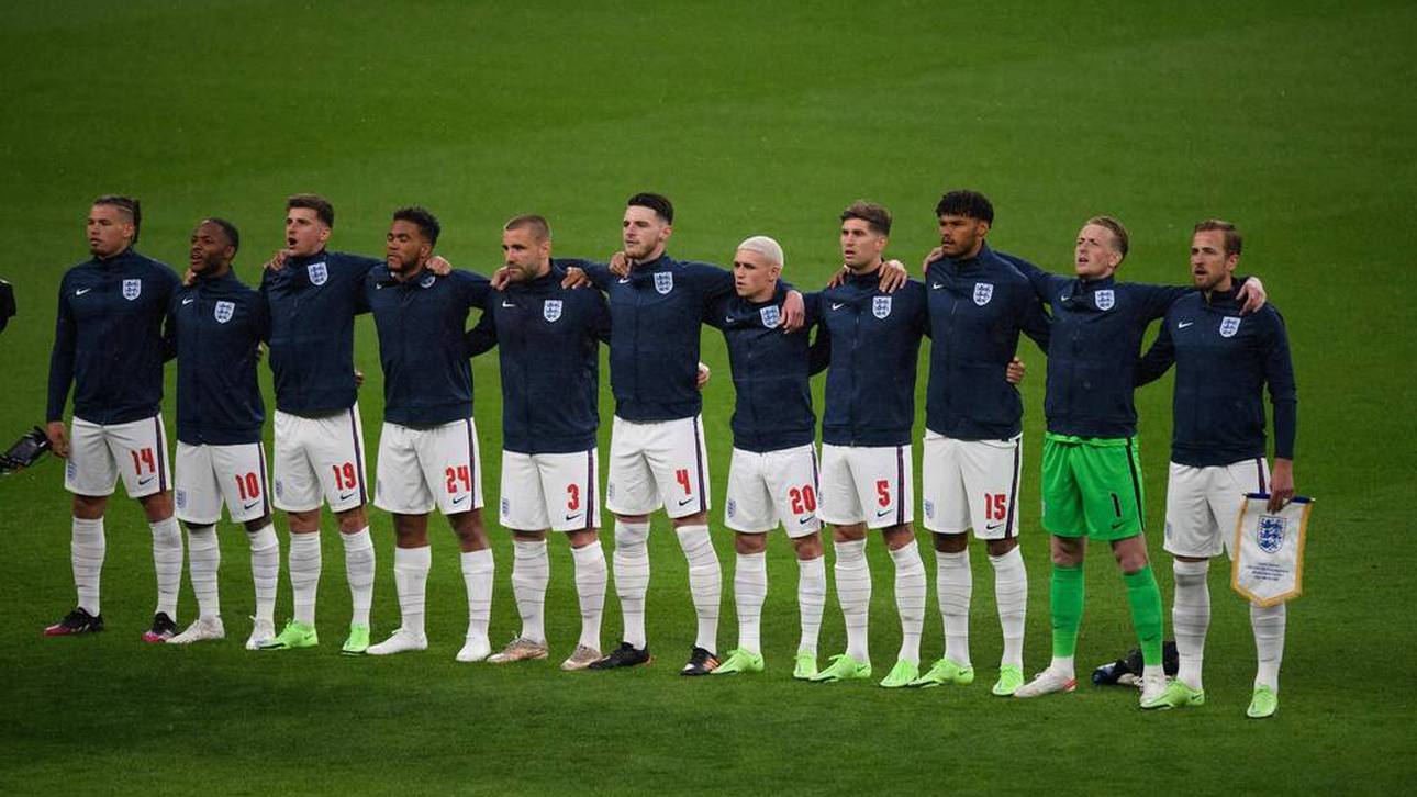 Kuriose Frisur-Wette bei England