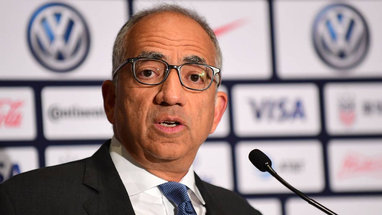 Sexismus: US-Boss tritt zurück