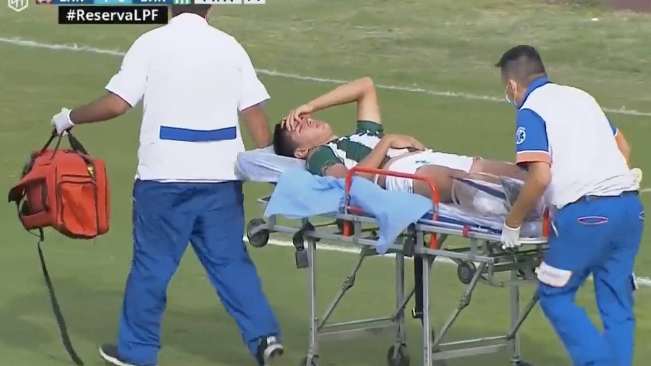 Horror-Verletzung in Argentinien