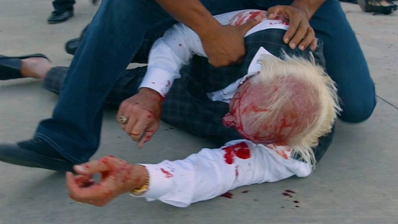 Blutiger Schock-Auftritt – mit 73