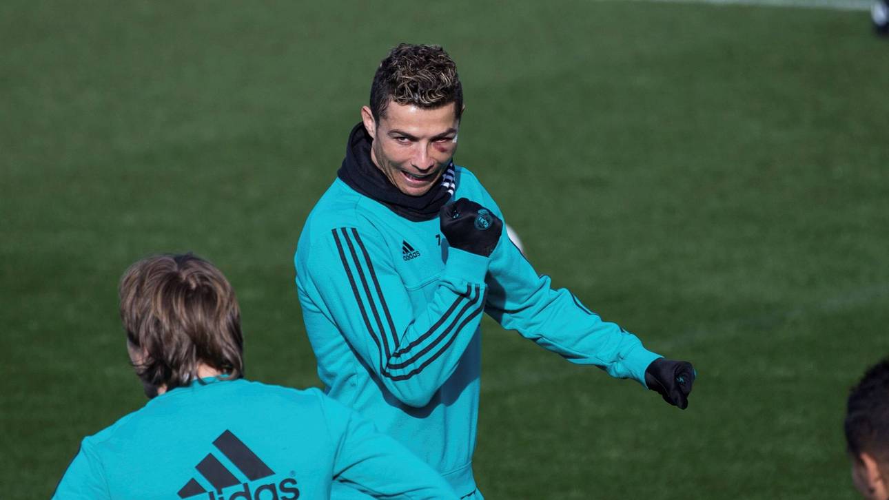 Ronaldo trainiert mit Mega-Veilchen