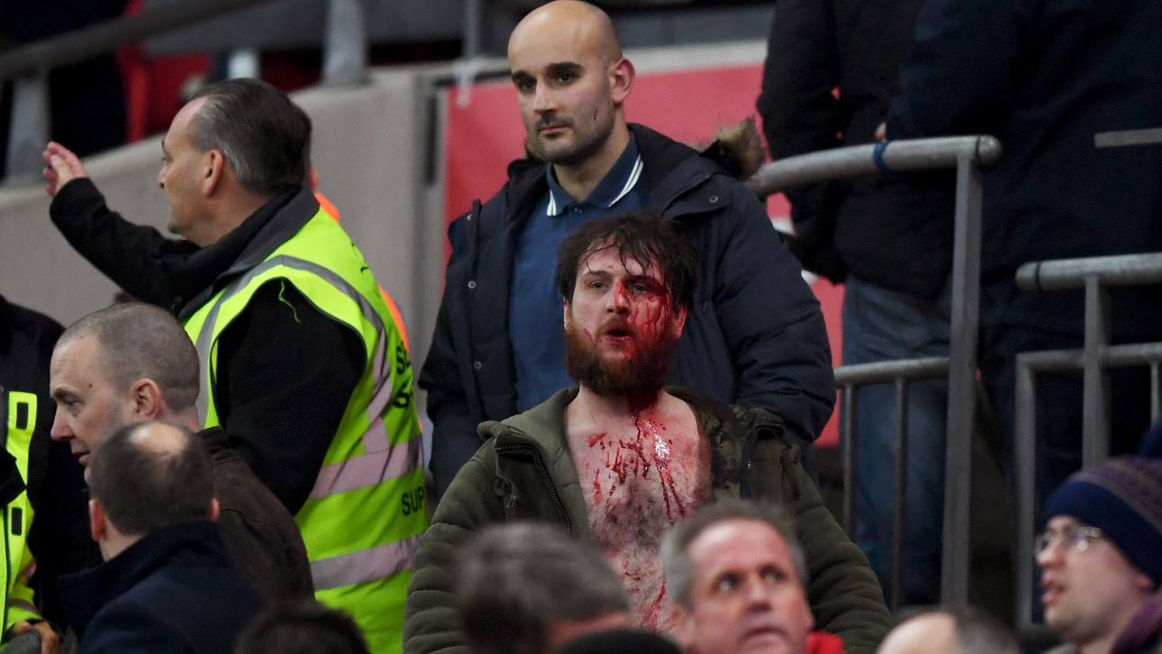 England-Fan blutig geschlagen