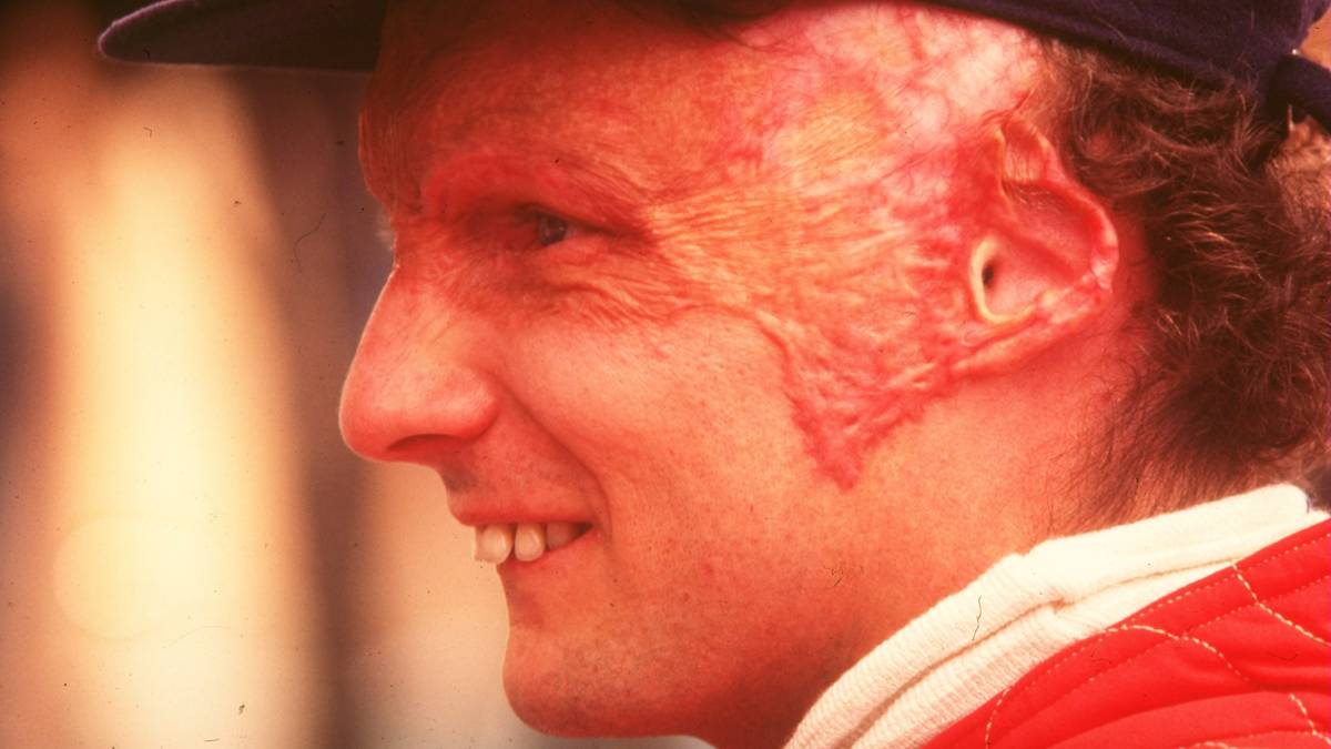 NIKI LAUDA 1976: Trotz seines schweren Unfalls auf dem Nürburgring steigt Lauda 42 Tage später wieder ins Cockpit. Er verpasst zwei Rennen, steht aber immer noch auf Platz 1 der Fahrerwertung. Vier Rennen stehen noch aus und vor dem letzten in Japan hat Lauda immer noch drei Punkte Vorsprung...