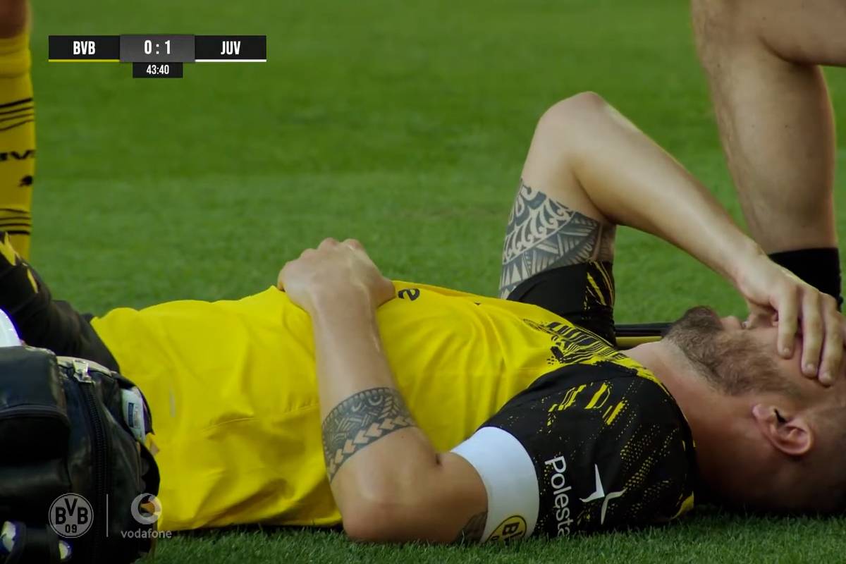 Niklas Süle hat sich im Testspiel gegen Juventus Turin verletzt. Der Innenverteidiger muss sofort ausgewechselt werden.