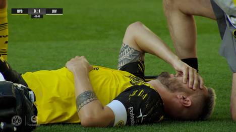 Niklas Süle hat sich im Testspiel gegen Juventus Turin verletzt. Der Innenverteidiger muss sofort ausgewechselt werden.