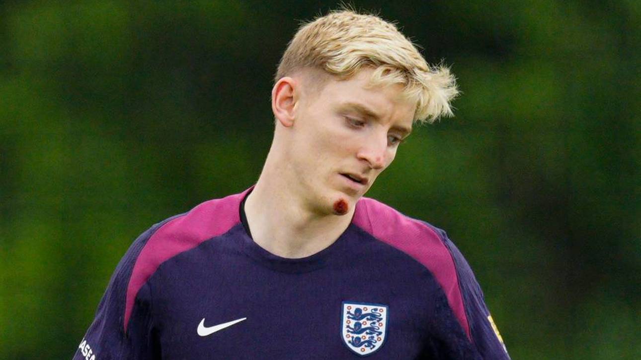 England-Ass mit Fahrrad-Unfall