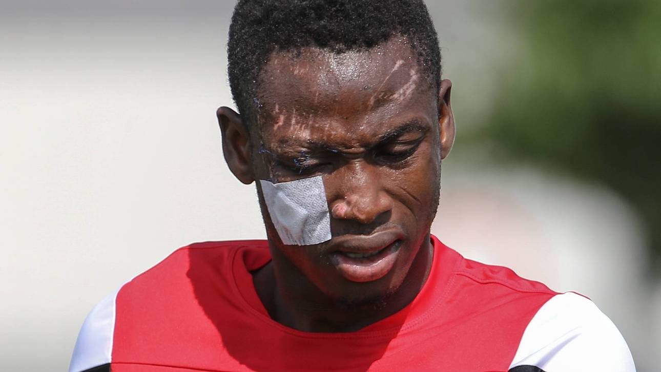 Augsburgs Baba bei Unfall verletzt